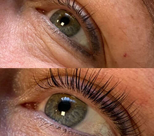 Treatment Highlight - LVL Lash Lift